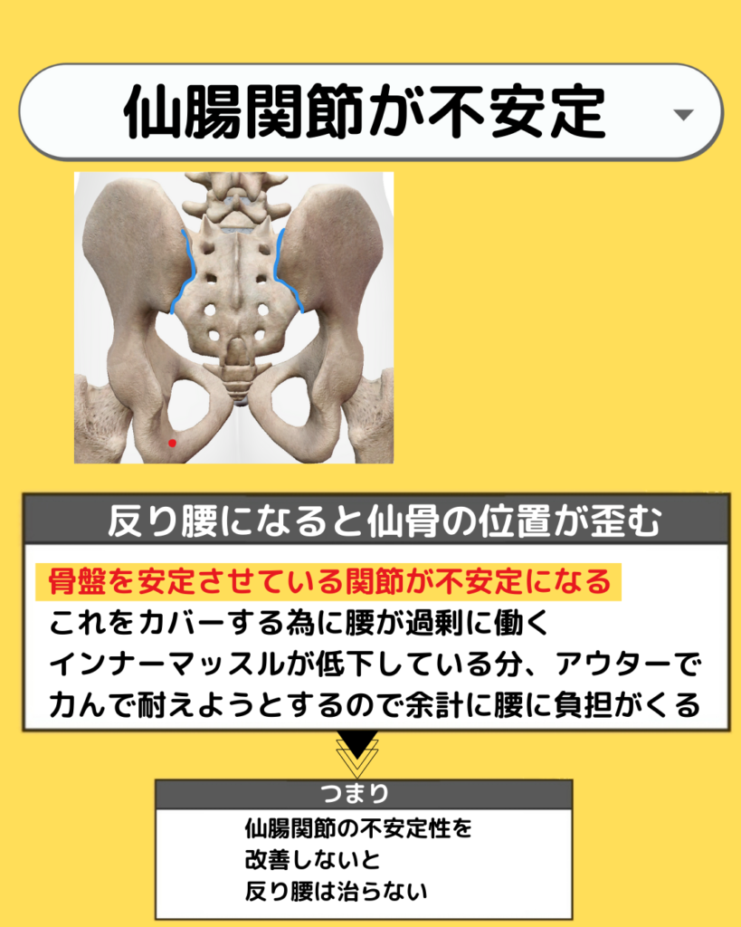腰痛の原因　仙腸関節性腰痛